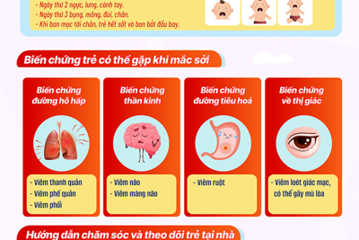 Bệnh sởi dễ gây biến chứng nguy hiểm