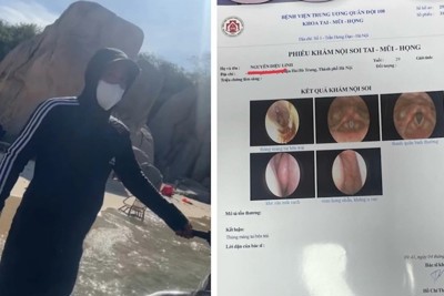 Làm rõ việc du khách Hà Nội bị hành hung thủng màng nhĩ tại Ninh Thuận