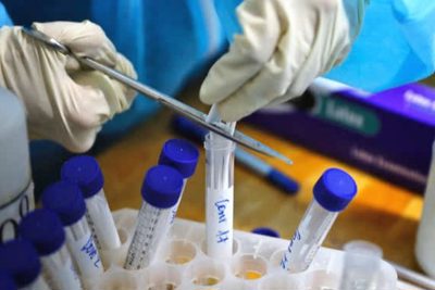 Sóc Sơn: 22 trường hợp liên quan 2 ca F0 tại Bệnh viện Việt Đức đều âm tính với SARS-CoV-2