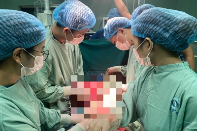 Quảng Ngãi: Loại bỏ thành công khối u xơ tử cung nặng 5 kg