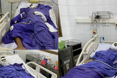 Quảng Ninh: Tàu cá bốc cháy, 3 anh em bị thương nặng