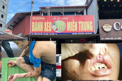 Tạm giữ hình sự nữ chủ quán tra tấn nhân viên quán bánh xèo ở Bắc Ninh