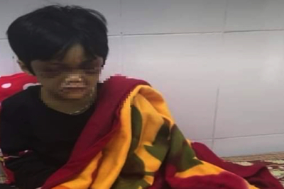 Hải Dương: Mẹ ruột bạo hành con gái 6 tuổi gây thương tích