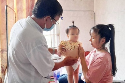 Bình Định: Hàng trăm người ở Bình Định bị ngộ độc bất thường