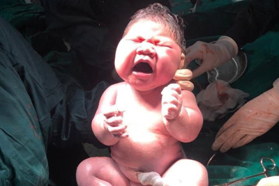 Bé trai nặng gần 6kg chào đời tại Bệnh viện Bệnh Nhiệt đới T.Ư