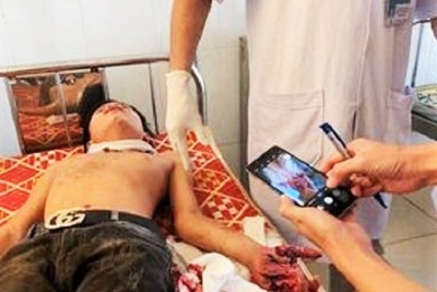 Hà Tĩnh: Máy tính phát nổ, 3 học sinh nhập viện cấp cứu