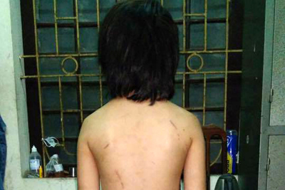 Vụ bé trai 10 tuổi bị bố đẻ bạo hành: Người cha nói gì tại cơ quan điều tra