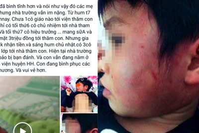 Thông tin chính thức vụ bé gái 4 tuổi bị đánh bầm tím khắp người ở Bắc Giang