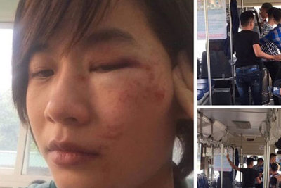 Hà Nội: Nữ phụ xe bị 4 nam thanh niên hành hung trên xe buýt 103B