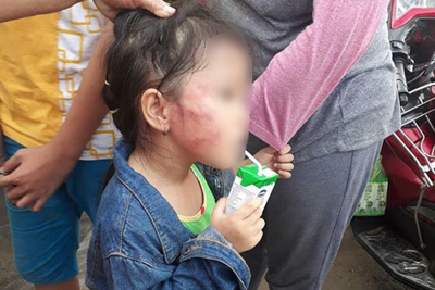 Bắt khẩn cấp bảo mẫu tát sưng mặt bé gái 5 tuổi ở trường mầm non