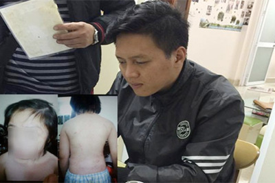 Hà Nội: Đề nghị khởi tố người bố bạo hành cháu bé 10 tuổi