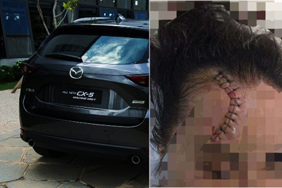 Truy tìm tài xế Mazda CX5 gây tai nạn khiến một cô gái bị thương nặng