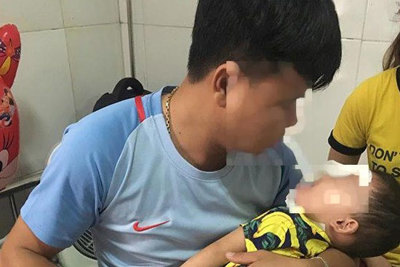 Nghệ An: Trẻ 2 tuổi bị chó nhà nuôi tấn công vào mặt