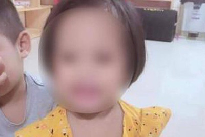 Hà Nội: Bé gái 3 tuổi bị đóng đinh vào đầu đã tử vong