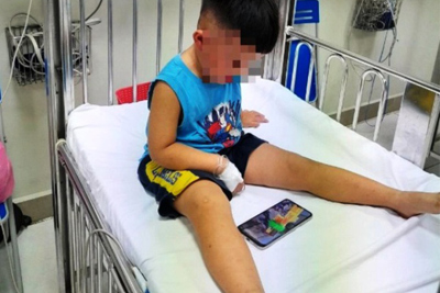 Bé trai hơn 3 tuổi nghi bị bạo hành phải nhập viện, đã qua nguy kịch