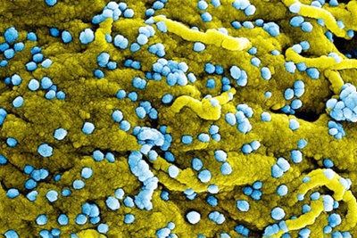 Làm gì để phòng ngừa virus Marburg?