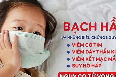 Thủ tướng ra công điện yêu cầu kiểm soát, không để lây lan bệnh bạch hầu