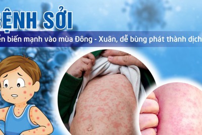 Thủ tướng yêu cầu tăng cường công tác phòng, chống bệnh sởi