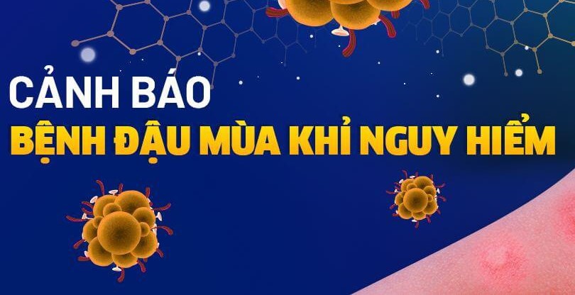 Bệnh đậu mùa khỉ (ảnh minh họa)