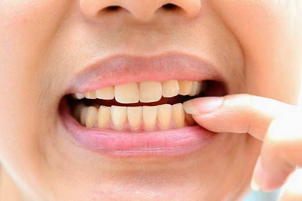 Những điều cần biết về kháng sinh và nhiễm trùng do răng - Ảnh 1