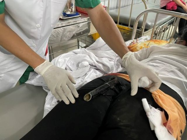 Tai nạn giao thông mới nhất ngày 13/2: Va chạm xe máy, bị chân chống xe găm vào mông phải nhập viện - Ảnh 1