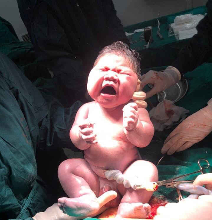 Bé trai nặng gần 6kg chào đời tại Bệnh viện Bệnh Nhiệt đới T.Ư - Ảnh 2