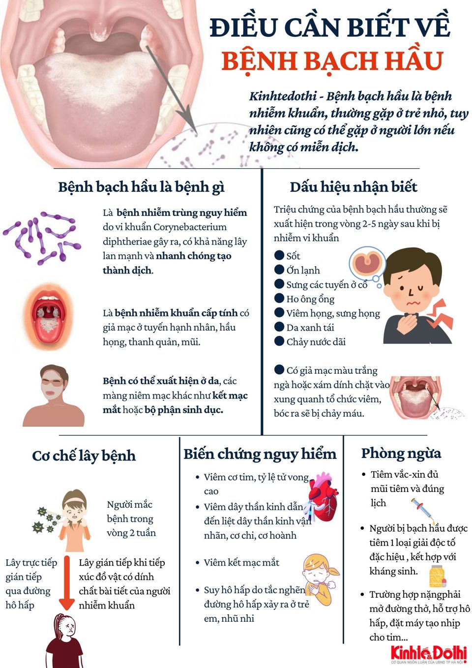 [Infographic] Điều cần biết về bệnh bạch hầu - Ảnh 1