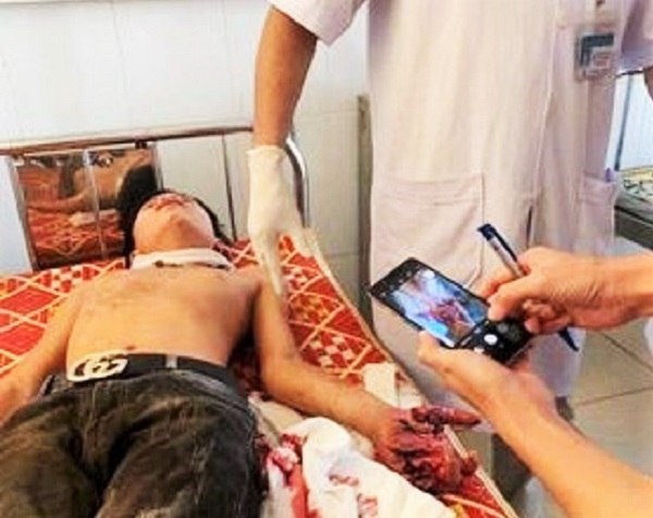 Hà Tĩnh: Máy tính phát nổ, 3 học sinh nhập viện cấp cứu - Ảnh 1