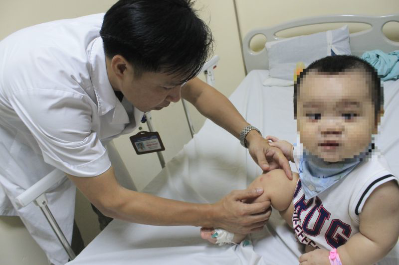 329 ca mắc tay chân miệng tại Hà Nội, Sở Y tế yêu cầu xử lý kịp thời ổ dịch - Ảnh 1