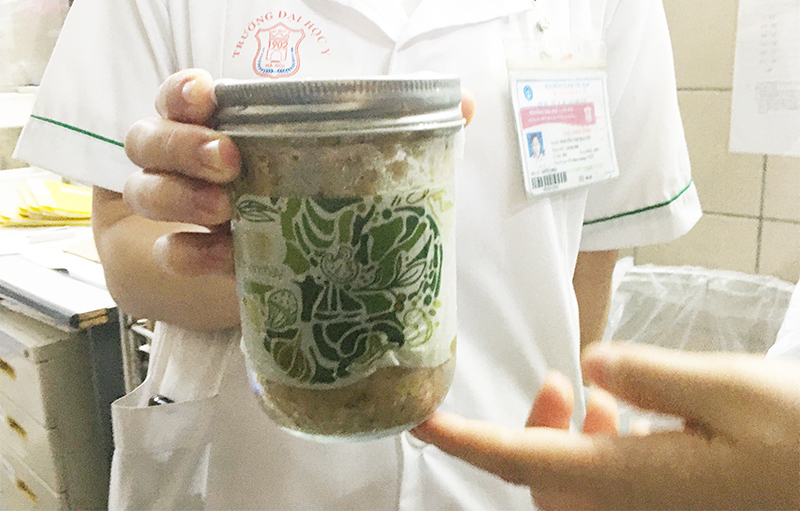 Cục An toàn thực phẩm lên tiếng quá trình xử lý vụ việc pate Minh Chay nhiễm vi khuẩn C.Botulinum - Ảnh 1
