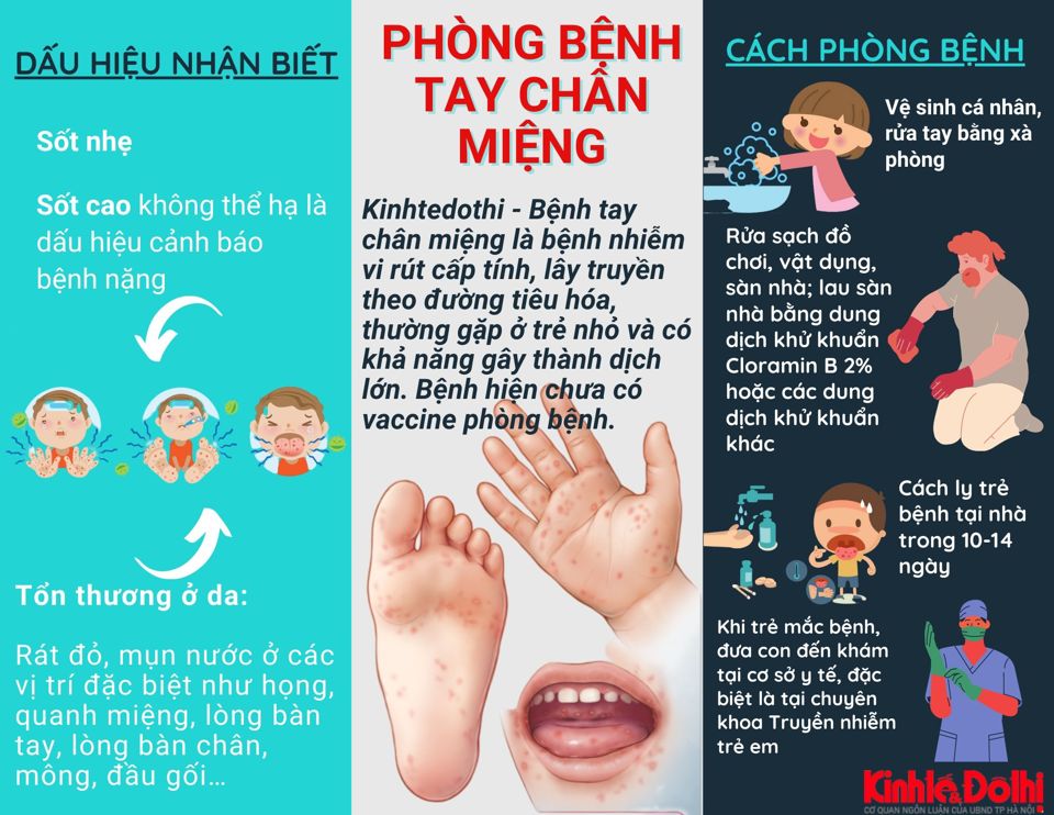 [Infographic] Đừng chủ quan với bệnh tay chân miệng ở trẻ em - Ảnh 1