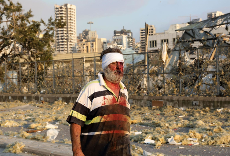 [Ảnh] Cảnh tượng như ngày tận thế sau vụ nổ kinh hoàng ở Beirut, Lebanon - Ảnh 11