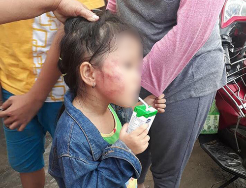 Bắt khẩn cấp bảo mẫu tát sưng mặt bé gái 5 tuổi ở trường mầm non - Ảnh 1