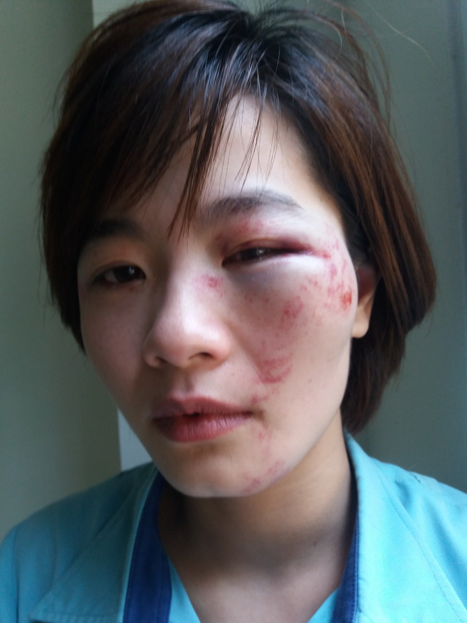 Hà Nội: Nữ phụ xe bị 4 nam thanh niên hành hung trên xe buýt 103B - Ảnh 2