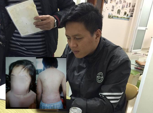 Hà Nội: Đề nghị khởi tố người bố bạo hành cháu bé 10 tuổi - Ảnh 1