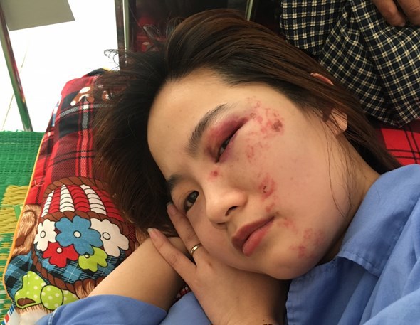 Hà Nội: Nữ phụ xe bị 4 nam thanh niên hành hung trên xe buýt 103B - Ảnh 3