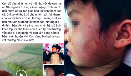 Thông tin chính thức vụ bé gái 4 tuổi bị đánh bầm tím khắp người ở Bắc Giang - Ảnh 1