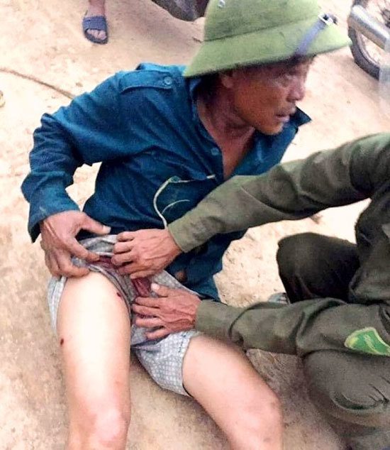 Hà Tĩnh: Người đàn ông bị bắn trọng thương khi đi làm rừng - Ảnh 1
