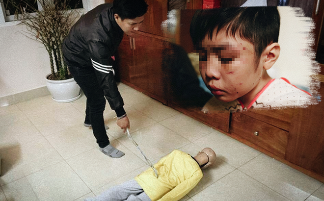 Chủ tịch Nguyễn Đức Chung chỉ đạo sớm kết luận vụ bé trai bị bạo hành - Ảnh 1