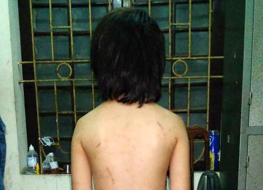 Vụ bé trai 10 tuổi bị bố đẻ bạo hành: Người cha nói gì tại cơ quan điều tra - Ảnh 2