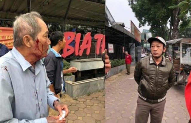Hà Nội: Điều tra vụ cụ ông 80 tuổi chạy xe ôm bị đánh nhập viện - Ảnh 1