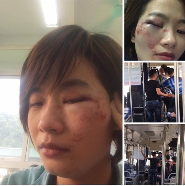 Hà Nội: Nữ phụ xe bị 4 nam thanh niên hành hung trên xe buýt 103B - Ảnh 1