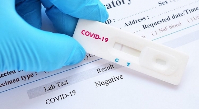Gần 98,5% mẫu xét nghiệm Covid-19 ở huyện Sóc Sơn cho kết quả âm tính - Ảnh 1
