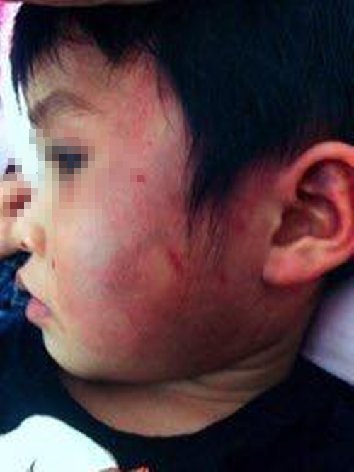 Bắc Giang: Phòng Giáo dục lên tiếng vụ bé 4 tuổi nghi bị bạo hành - Ảnh 1