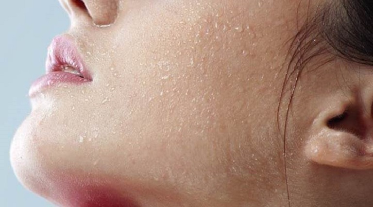 8 Cách trị da mặt sần sùi khô ráp cho làn da khỏe mạnh