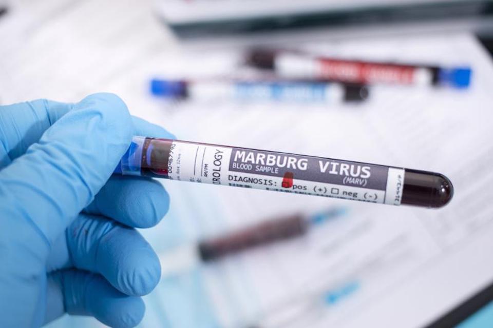 Hiện số ca nhiễm virus Marburg đang tăng tại nhiều quốc gia...Ảnh: Newsweek