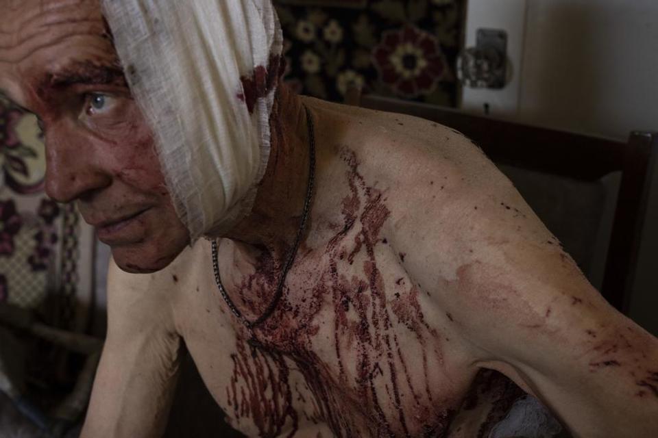 Volodymyr, bị thương, ngồi trong căn hộ bị hư hại của m&igrave;nh ở Kramatorsk, v&ugrave;ng Donetsk, miền Đ&ocirc;ng Ukraine, ng&agrave;y 7/7/2022.