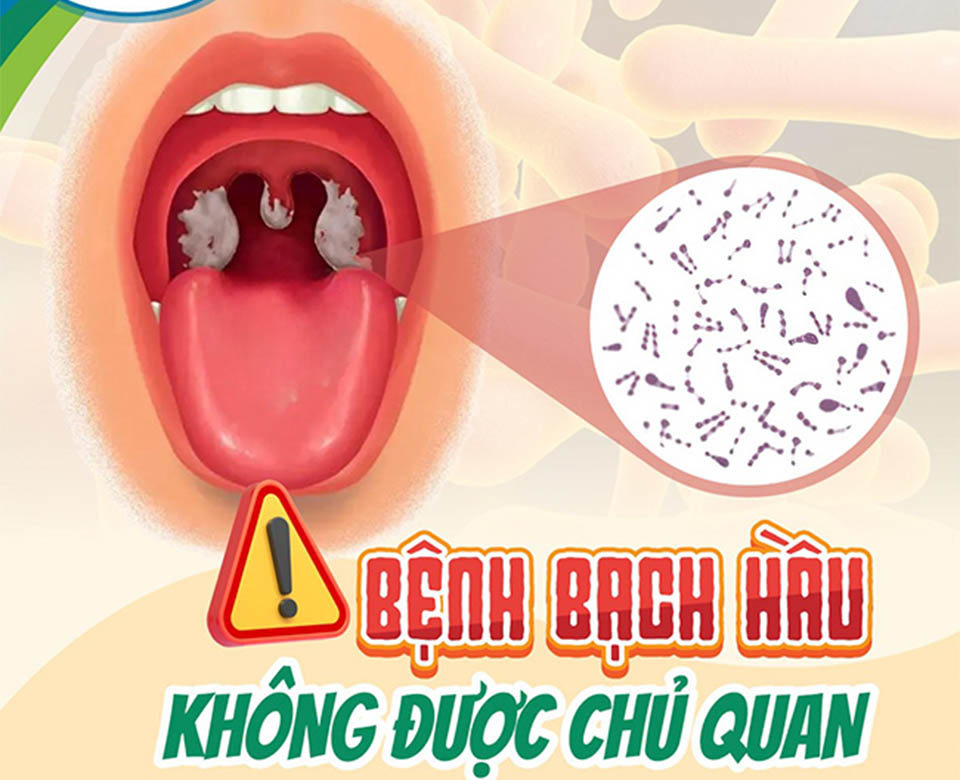 Người d&acirc;n kh&ocirc;ng được chủ quan với b&ecirc;̣nh bạch h&acirc;̀u.