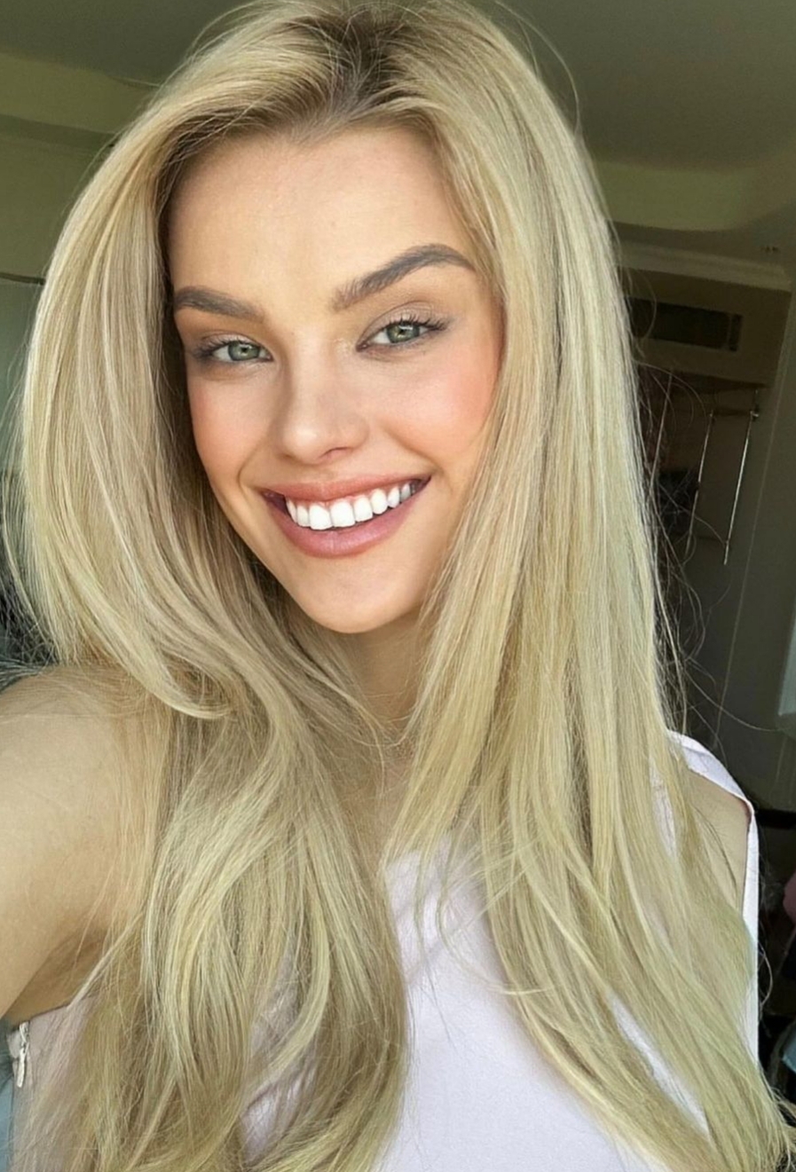 Nụ cười rạng rỡ của T&acirc;n Hoa hậu Thế giới Miss World 2024. Ảnh: Instagram