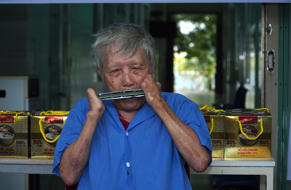 Bệnh nh&acirc;n phong lạc quan biểu diễn&nbsp;harmonica.&nbsp;